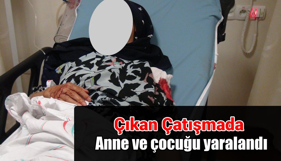 #Siirt 'te Çıkan çatışmada anne ve çocuğu yaralandı

siirthaberleri.com/tr-TR/haberler…