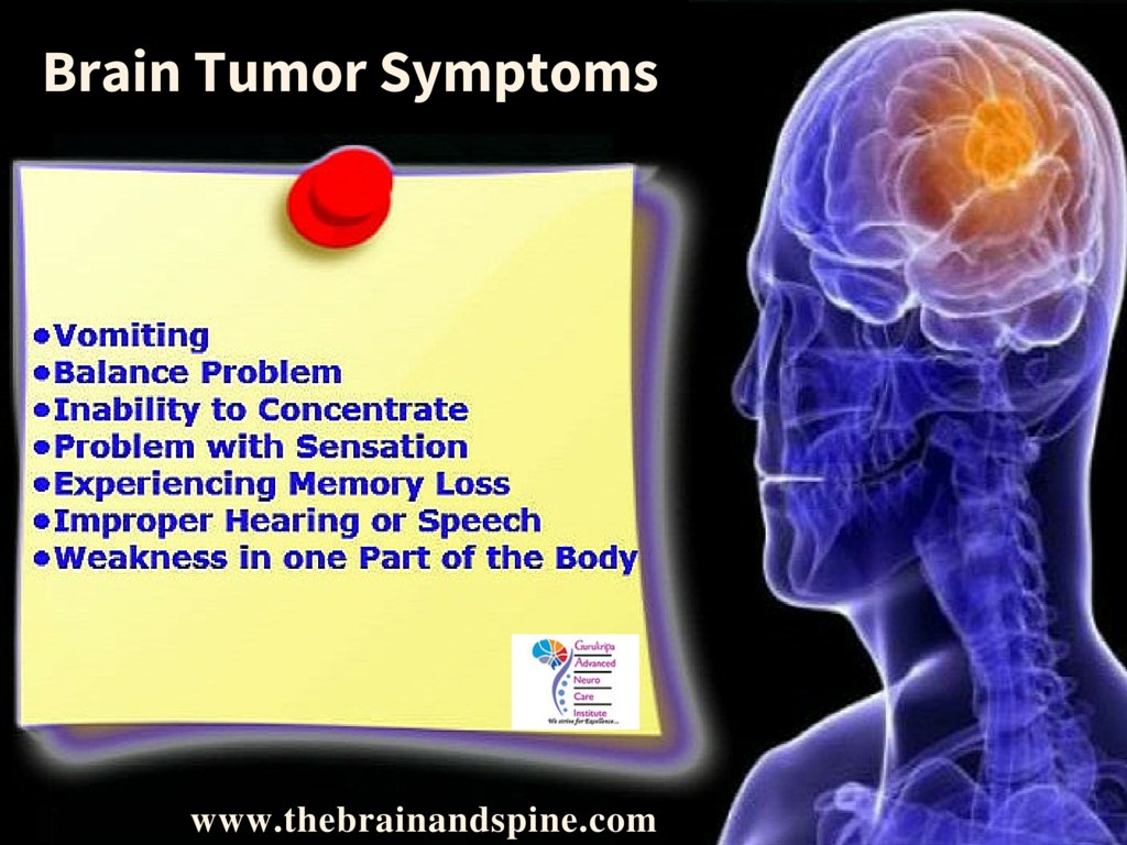 sushrutcom's tweet image. The general signs of #BrainTumor are #Vomitting, #BalanceProblem, #MemoryLoss.. thebrainandspine.com/brain-tumors.#… #Delhi
