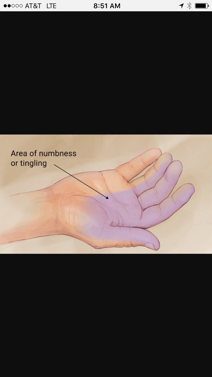 jbaker265's tweet photo. CNN headline: Carpal Tunnel cases on the rise after UMC voting goes into second day. https://t.co/rNVazB24ar