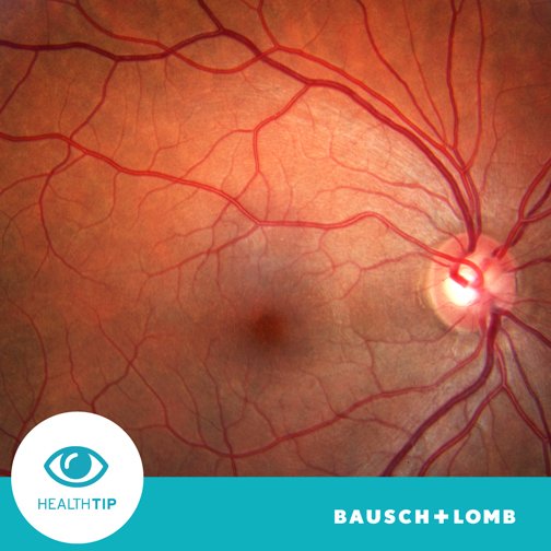 bauschlombca's tweet photo. Your eyes are as incredible on the inside as they are on the inside. Take a look with some #retinalphotography https://t.co/WM9HWleUDJ