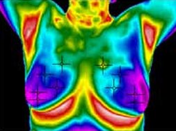 Thermography London tweet media