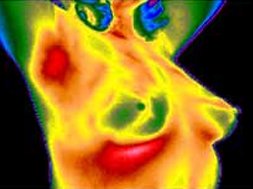Thermography London tweet media
