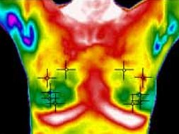Thermography London tweet media