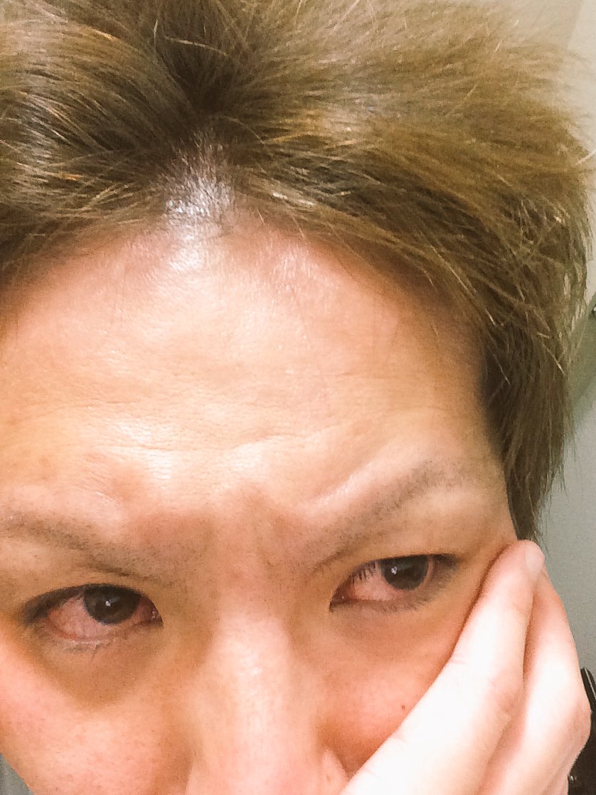 狩野英孝 On Twitter ガキ使で眉毛を全部剃って 少しだけはえて来