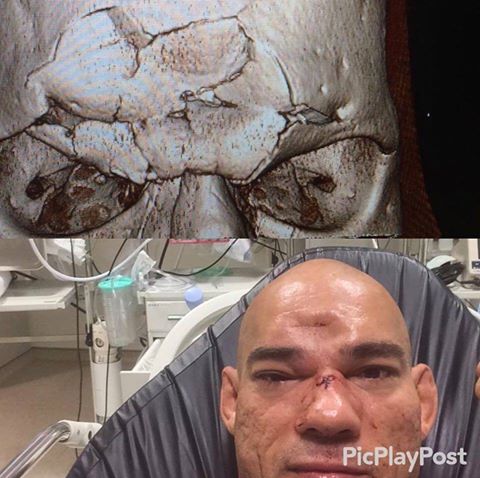 BeWarmers's tweet photo. WOW: Look at the Damage Michael "Venom" Page did with that knee https://t.co/KQyYnuuyuw