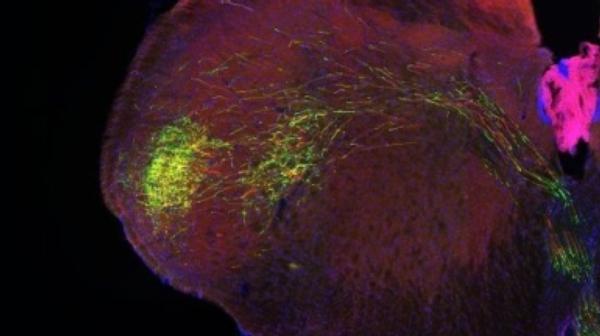 scienceanglr's tweet image. #BrainData Gold Mine Could Reveal How #Neurons #Compute bit.ly/2a0IGbl