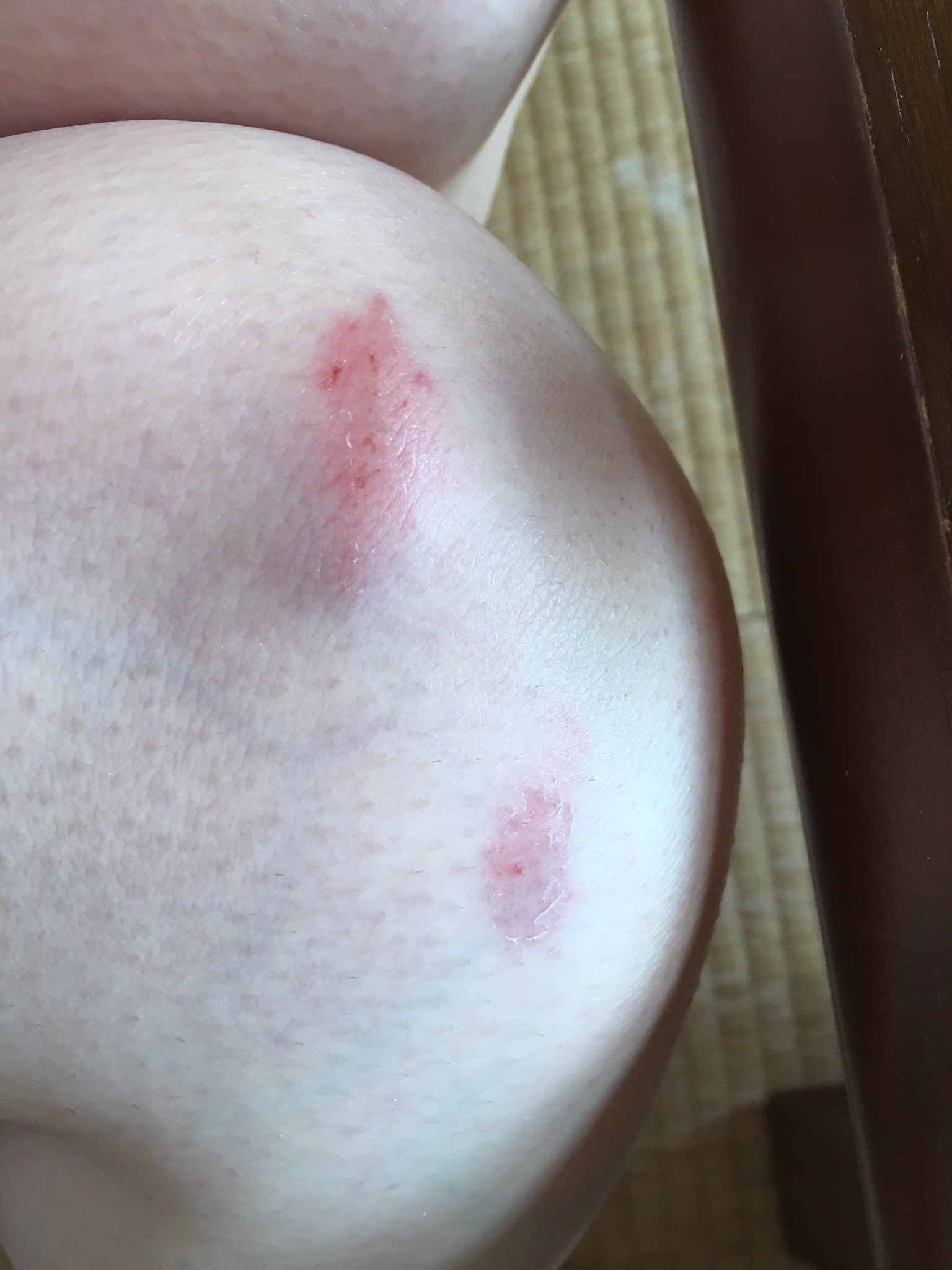 森由香on Twitter 痛い 膝 怪我したt T T Co Mrajmitn8q Twitter 森由香on Twitter 痛い 膝 怪我したt T T Co Mrajmitn8q Twitter