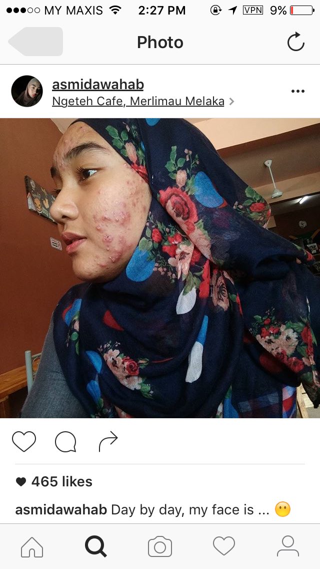 FatinLeeya's tweet image. She's right. Nikmat kecantikan tu bila2 je Allah boleh tarik. Bersyukurlah girls out there and get well soon to you😞
