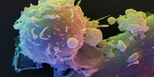 ScienceMagazine's tweet photo. We're pleased to announce the launch of our newest journal, Science Immunology! Learn more: https://t.co/Q4RFPXHYKD https://t.co/yQFanoXRf4