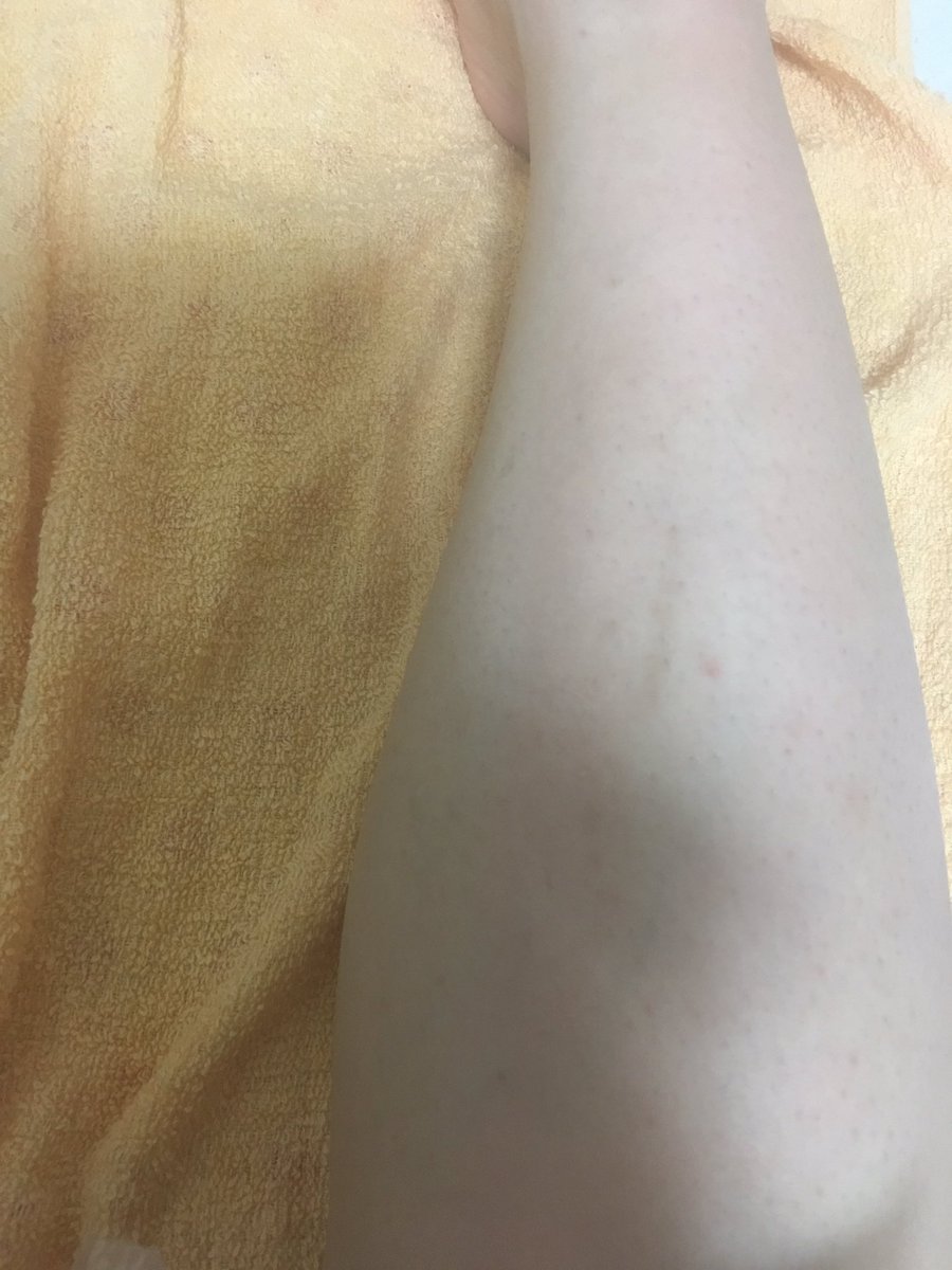 毛が濃い 毛が濃い