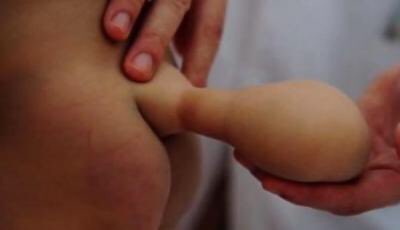 This baby was not born with a tail but grew a Spina bifida after birth <a href="/phaphamamlfm/">#PhaphamanaMunghana</a>