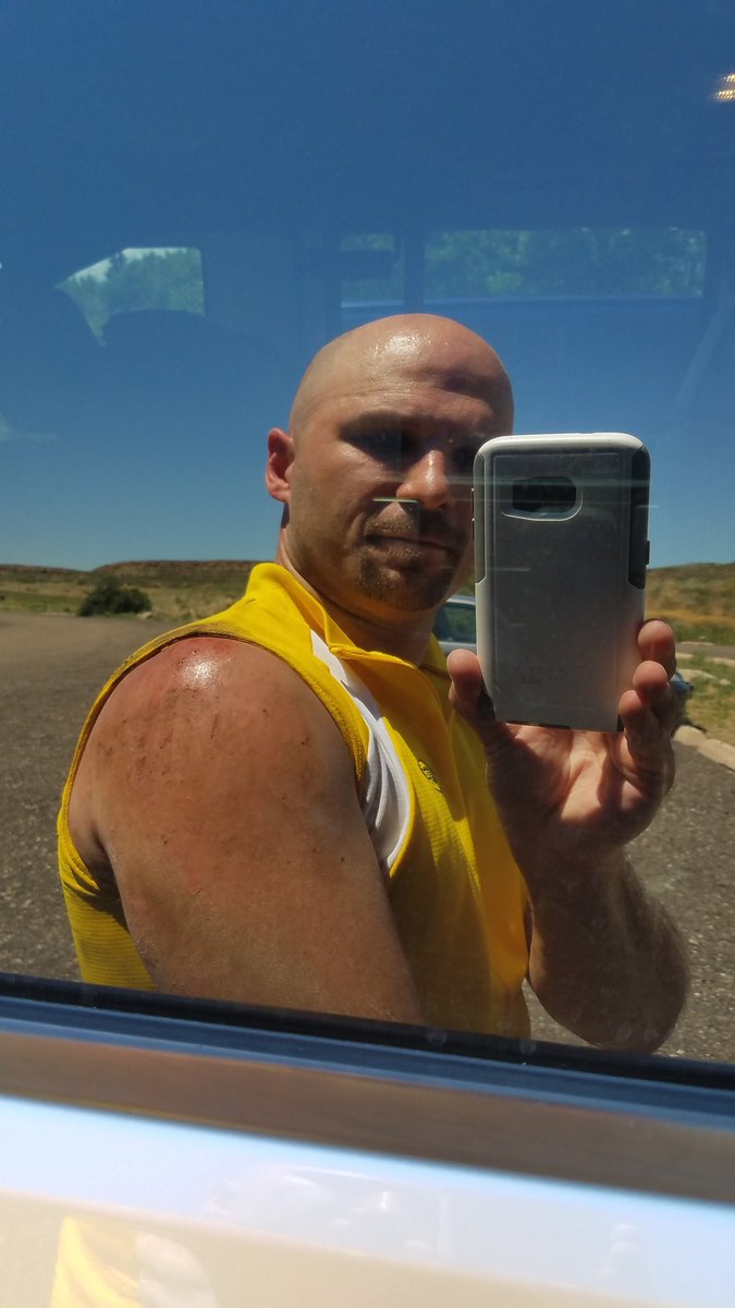 dave_needum's tweet photo. #GravityNinjasSuck #20mphDirtRash #mountainbiking https://t.co/7sPn2rmsxo