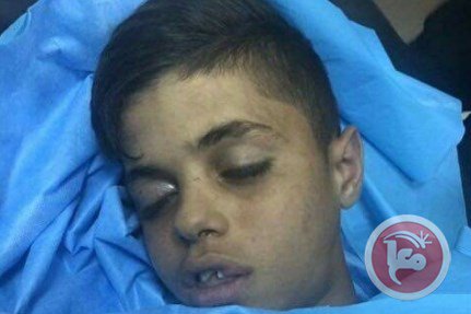 FriendsofAlAqsa's tweet photo. Israeli soldiers kill 12-yr-old boy with rubber bullet during clashes in central West Bank https://t.co/VgDMYR3eu4 https://t.co/uh94tMeyw7