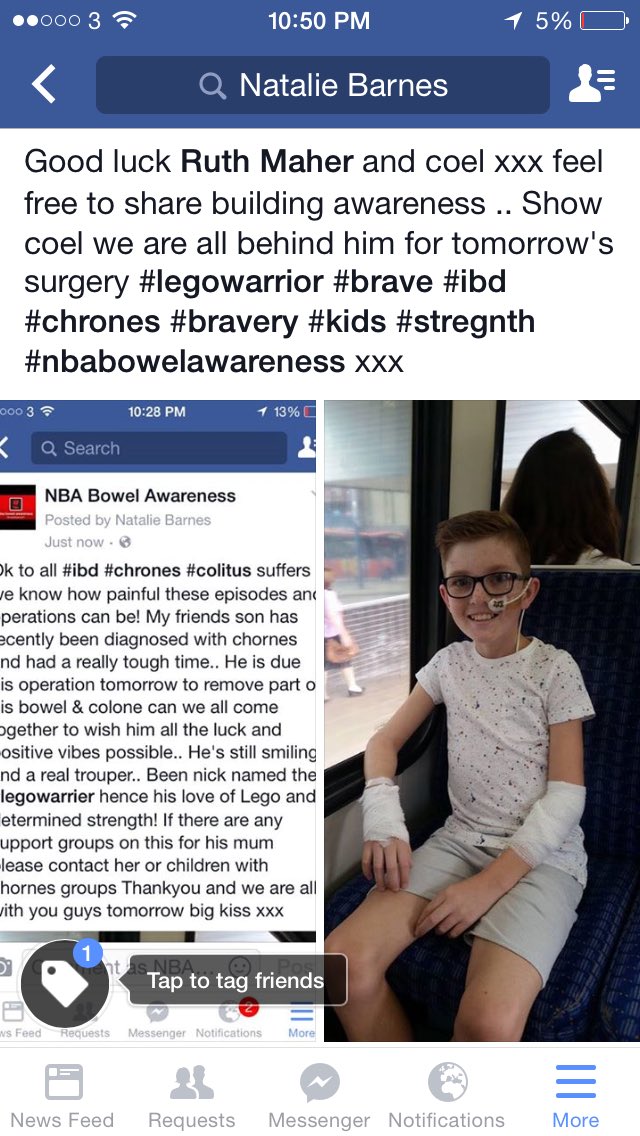 nataliealice21's tweet image. #legowarrior #chrones#kids #surgery #mums #goodluck #stregnth #bravery #ibd #awareness #nbabowelawareness pls rt xx