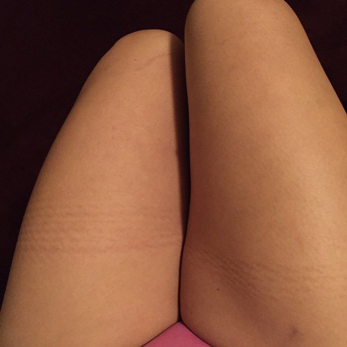 When bae leaves you hickeys. Thanks @JohnPaulthePope https://t.co/nGc5RgLyCU<a class="tags" href="/tag/johnpaulthepope">@johnpaulthepope</a>