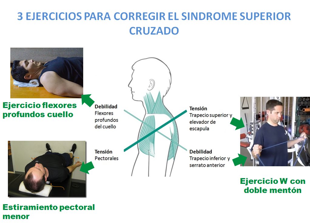 Lo prometido es deuda. Ejercicios correctores del síndrome cruzado superior, aportaciones del crack <a href="/mikereinold/">Mike Reinold</a>