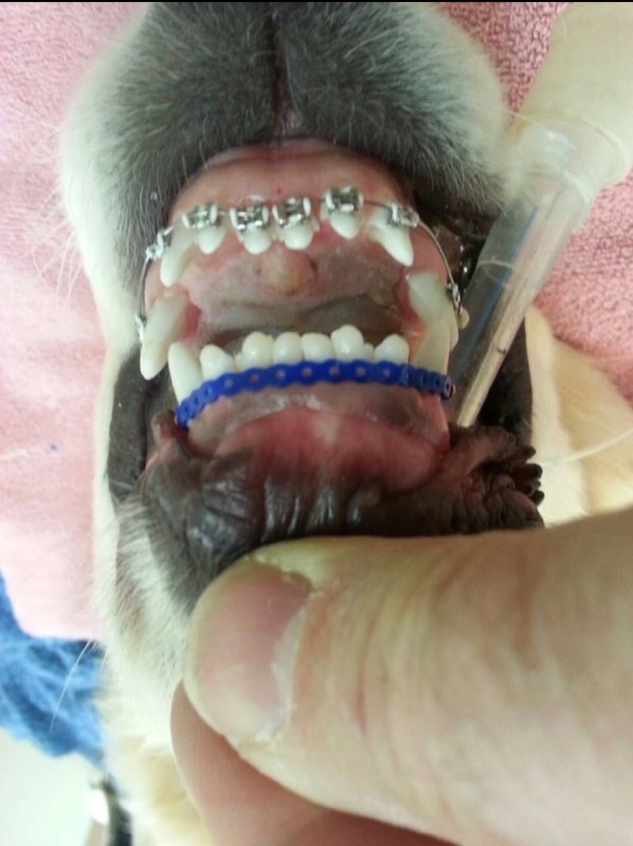 This little guy had to get braces and it is the cutest thing ever