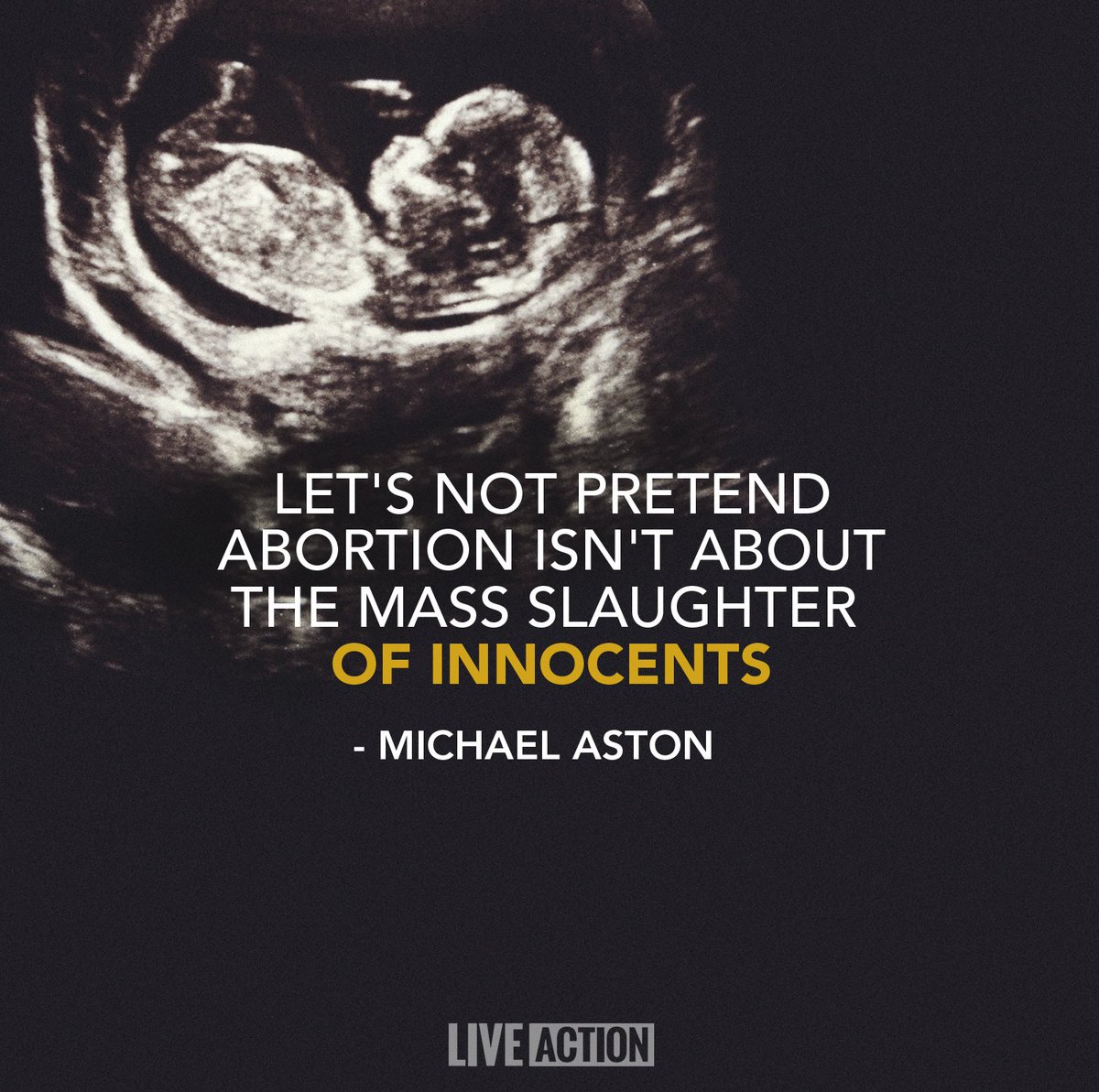 LiveAction's tweet photo. "Let's not pretend abortion isn't about the mass slaughter of innocents." - Michael Aston #prolife https://t.co/Ut6KYyF2Xk