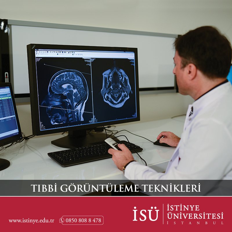 #TercihimYaşatmak  
Tıbbi Görüntüleme Teknikleri Bölümü hakkında detaylı bilgi için; istinye.edu.tr
