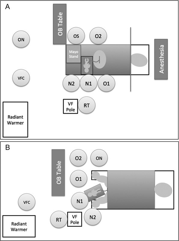 AmJPerinatology's tweet photo. Ventilation of #Preterm Infants during #DelayedCordClamping (#VentFirst) https://t.co/GZjly7cLWl https://t.co/KOVkqRWRZY
