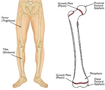 SolarHealthDrs's tweet photo. #LimbLength discrepancy is a condition where one limb is a different length than the other: https://t.co/dJO3lVfNM9 https://t.co/6aeYxFI3Vi