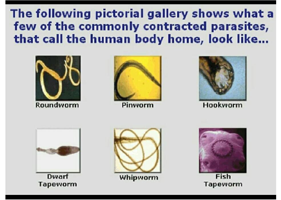 LifeForceOrgone's tweet photo. #parasites in the body #gross #Orgonite, #ParasiteZapper #Healing. https://t.co/UpJUtpSzpr
#fightcancer #cancer https://t.co/iqVQHIBliC