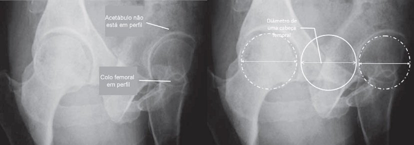 e_Radiologia's tweet photo. Proposta de Padronização do Estudo Radiográfico do #Quadril e da #Pelve - https://t.co/U0DaqaBNUF https://t.co/FTTjAozJYS