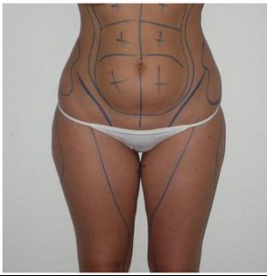 Samparlebien's tweet image. Après avoir regardé 1000 sites de tatouages, sur IG, sur FB.. j'ai ENFIN trouvé le tatoo que je voulais me faire &amp;lt;3