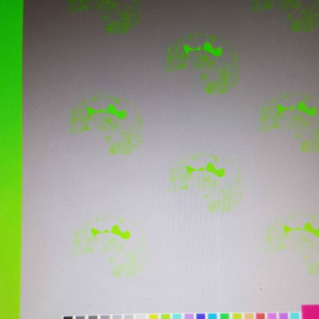 mskirstystevens's tweet photo. Green is officially my fave.... #sneakpeek of @charcotstudio latest samples.... #redesigningMRIscan #mriscan #greys⦠https://t.co/Ef8XGYmMFs