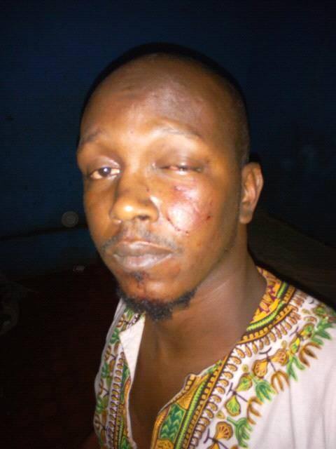 GuineeBuzz's tweet photo. #CHOC L'artiste #Bagada #Wonson #Bah a été agressé par des bandits hier au retour d'une veille.Prompt retablissement https://t.co/l7wrRjWeRv