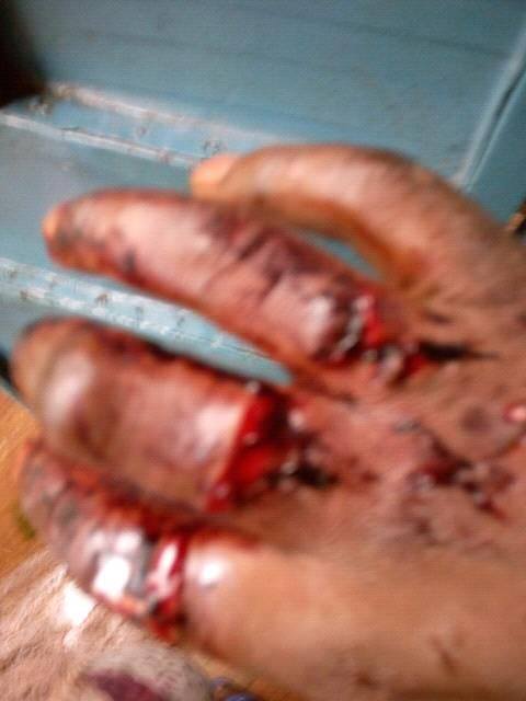 GuineeBuzz's tweet photo. #CHOC L'artiste #Bagada #Wonson #Bah a été agressé par des bandits hier au retour d'une veille.Prompt retablissement https://t.co/l7wrRjWeRv