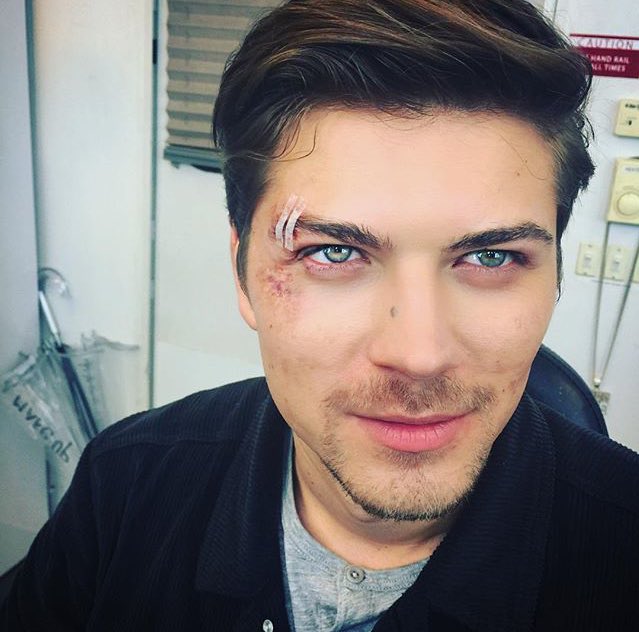 AScarredMemory's tweet image. "Guess who's back."