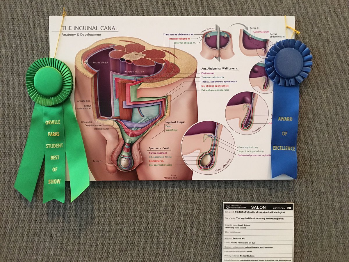 msh_ko's tweet photo. Some cool pieces in the salon #AMI2016 #medicalillustration #biocommunication https://t.co/IfXFzG0211