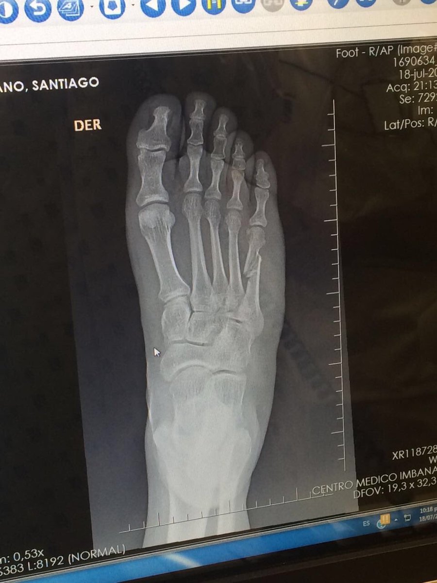 sagoserrano's tweet photo. Lo malo de estar incapacitado, es que lo hagan sentir incapacitado! https://t.co/vxeFmz4crx