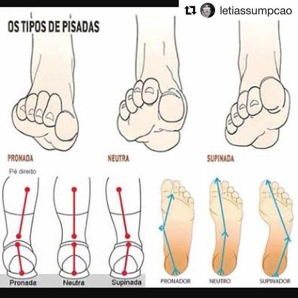 tipos de pisada pronada supinada e neutra