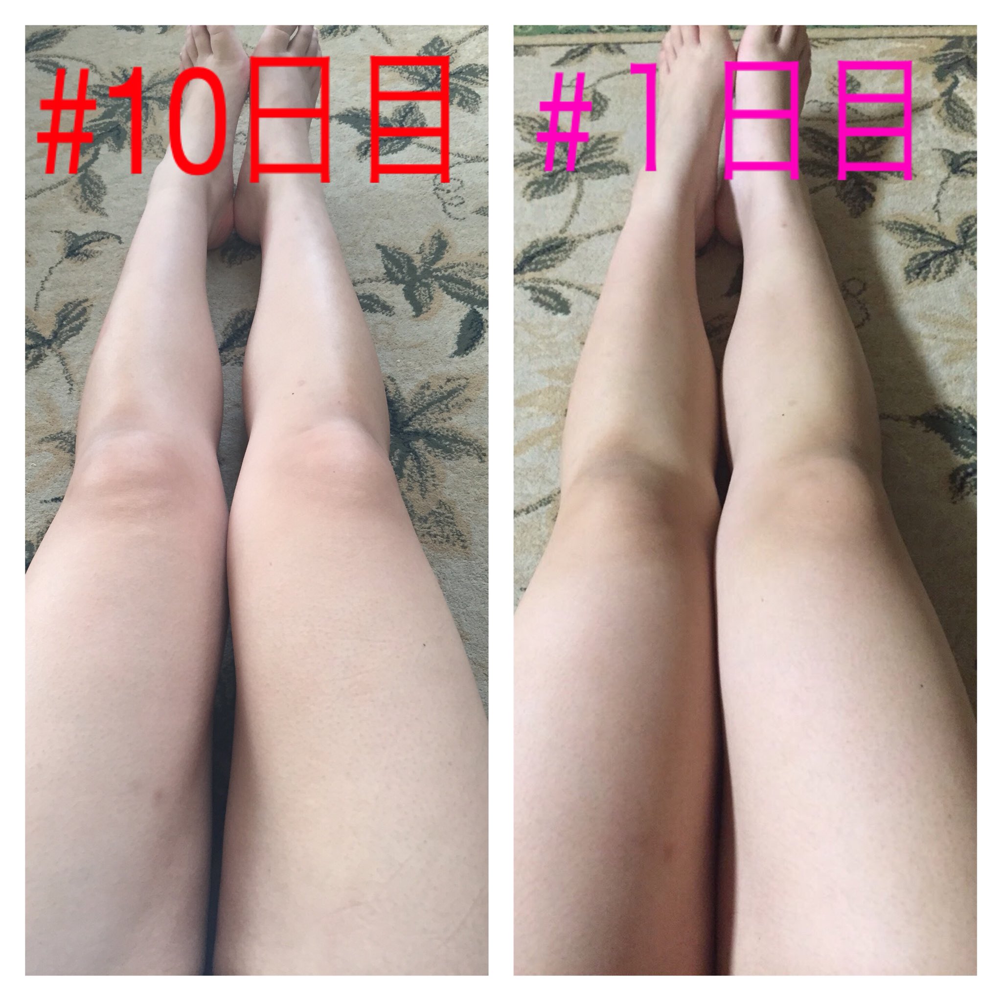 やーたん ダイエット一日目の足とダイエット10日目の足 です ふくらはぎも太もものあたりも隙間出来てる これもだまちゃんのおかげ あと マッサージする時にはリピアのマッサージクリームがオススメです 痩せたと思ったらrt ダイエット仲間募集