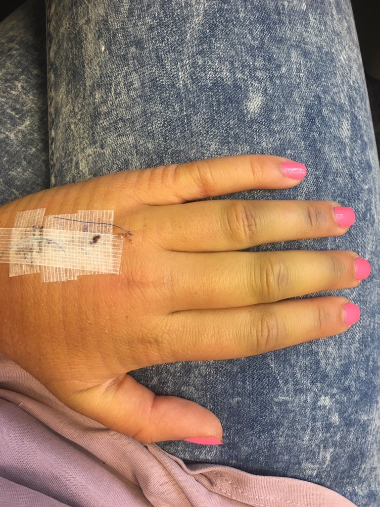 Ouch !!! When Caitie steps on Megs hand 😕 #poormimi #badbug @meghanweinewuth <a href="/caitieweinewuth/">Caitie Weinewuth</a>