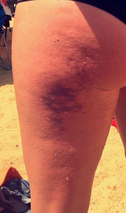 midwest_mess_'s tweet photo. Twenty foot cliff won! #fugitivebeach https://t.co/tUlL5jWsky