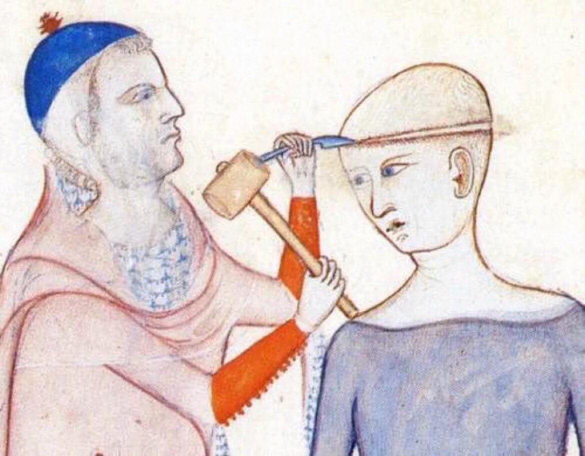 When your friend says something stupid and you have to check if they have a brain