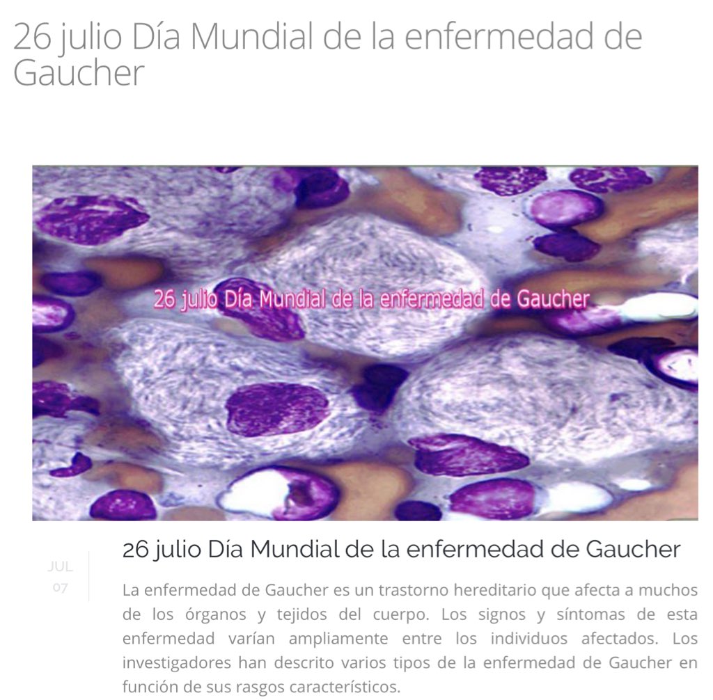 NoInvisibles's tweet photo. 26 Julio #DiaMundialGaucher
#InternationalGaucherDay #Gaucher
https://t.co/EmvvticGGk
Gracias @SaludYProfesion #fb https://t.co/nW0K5cwZXi