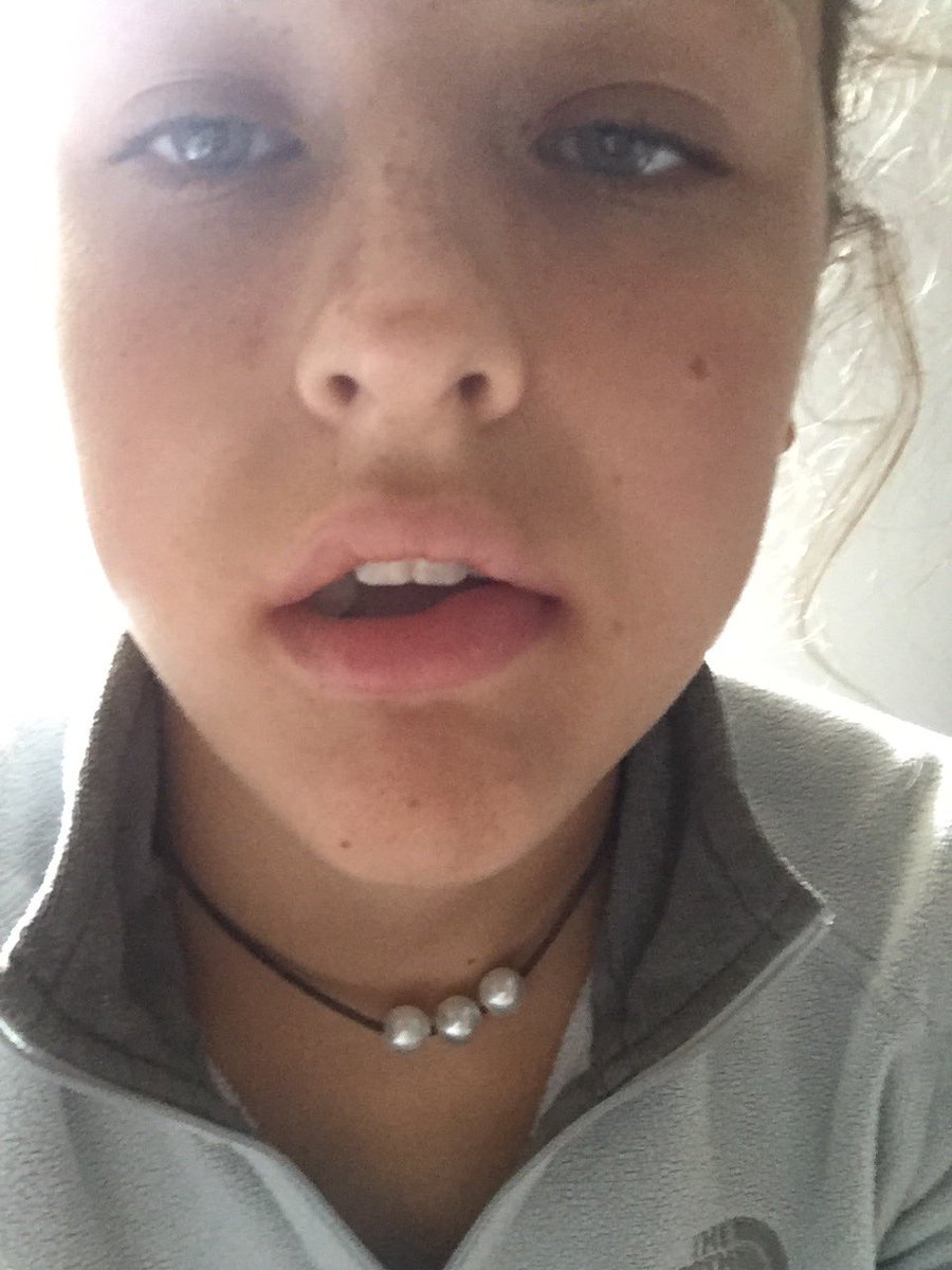 carlygess's tweet image. twins? #wisdomteethprobs