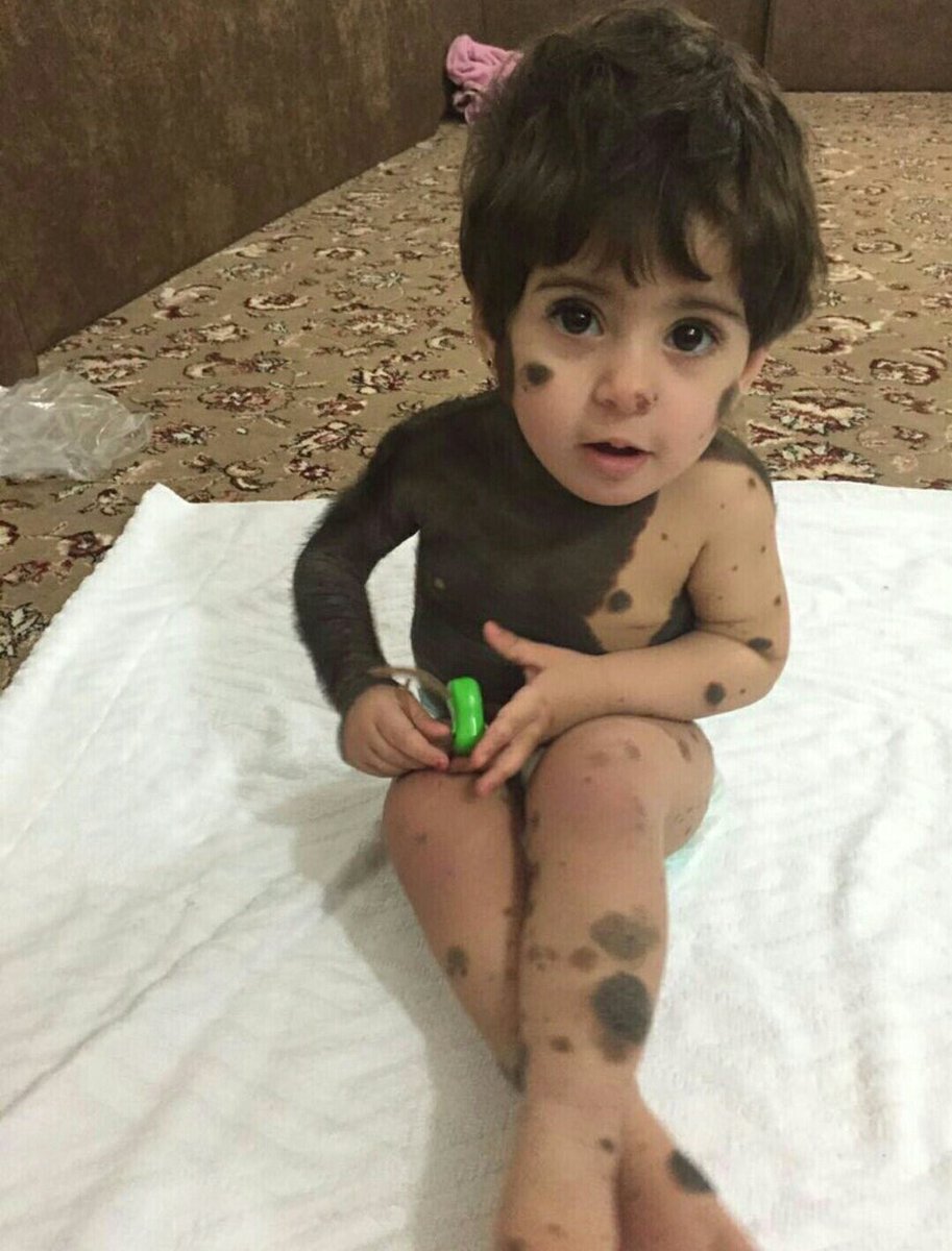 mamdouhAlmalki's tweet photo. @AboShla5Libraly هالوجه يستحق الدعم

الله يسخر لها من اهل الخير من يكون سبباً لعلاجها
#الين_فيصل_العنزي https://t.co/vyjMOwJSh8