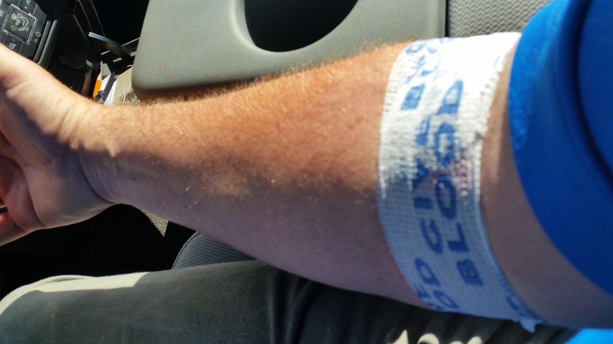 goobietown's tweet photo. Didn't hurt too much.....and free cookies! !! #peakfreens #nobrainer https://t.co/P2bF90xvOK