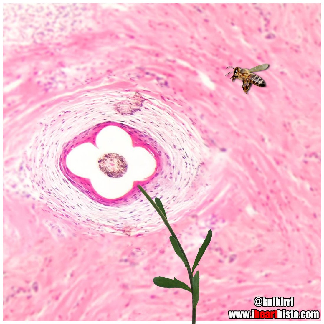 IHeartHisto's tweet image. 🌸 I'm Pollen My Hair Out! 🌸
What in carnation?! 
This follicle looks like a bloomin' daisy!
#histology #pathologists