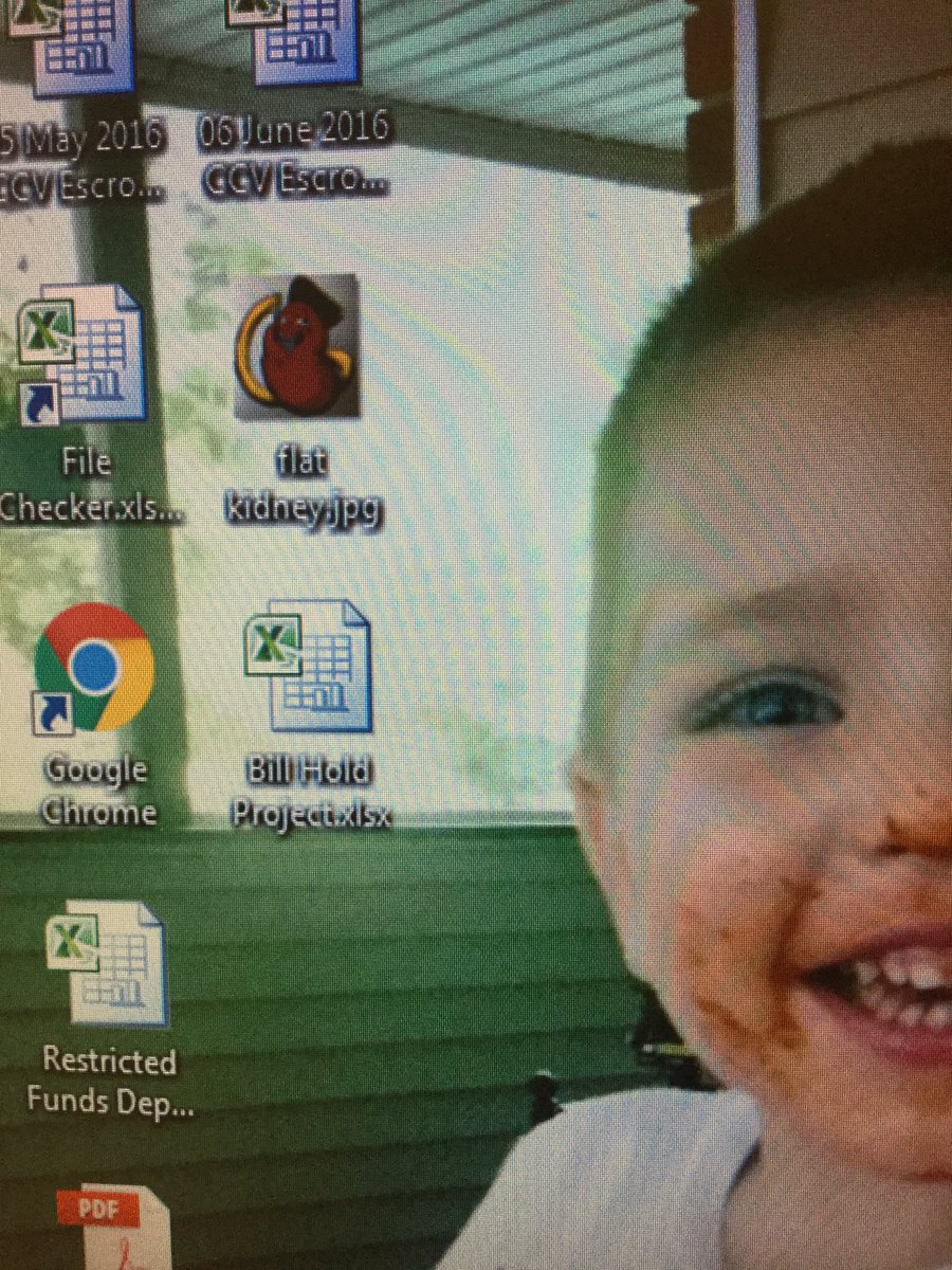 LilSallyScoop's tweet photo. Thanks for hanging out on my desktop at work all day @FlatKidney to keep me company! @HeyScoops #flatkidney https://t.co/yf63jQan2d