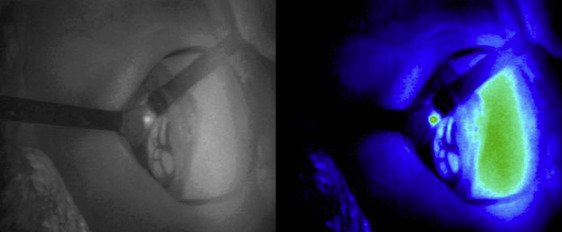 acsJACS's tweet photo. Coming in August: Cutting Edge in Thyroid Surgery: Autofluorescence of Parathyroid Glands. https://t.co/66Dqssi1kB https://t.co/S4R8UmK30Z