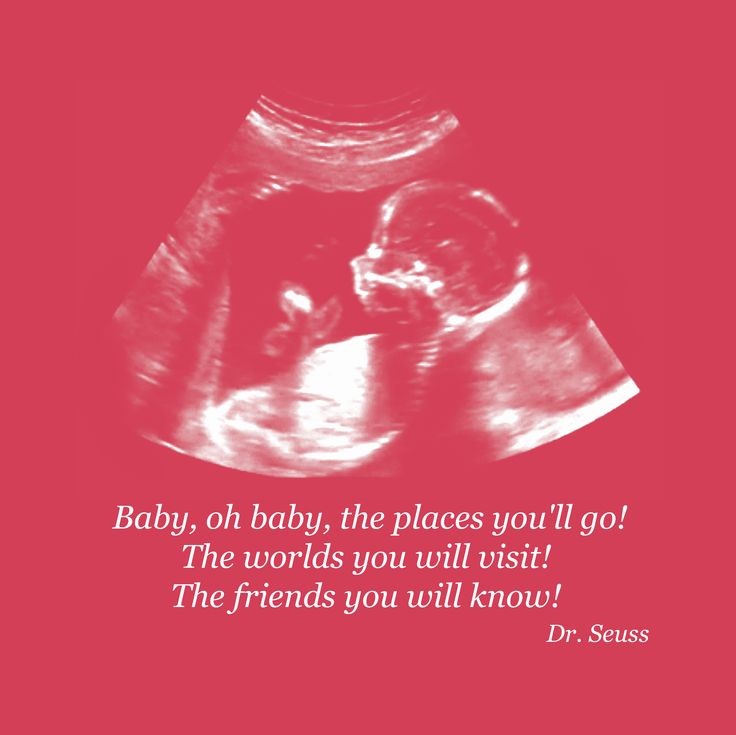 TrinityDiag's tweet photo. We do obstetrics! #ultrasound #baby #obstetrics #blessings https://t.co/V8S99QaSPT