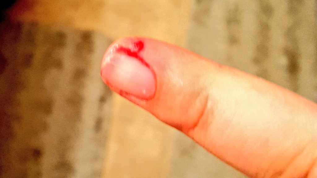 thenameismamma's tweet photo. When your beardie REALLY wants grapes and gets a chunk of your finger instead #ouch #lizardfood #beardie #saddragon https://t.co/OPySoxr5wO