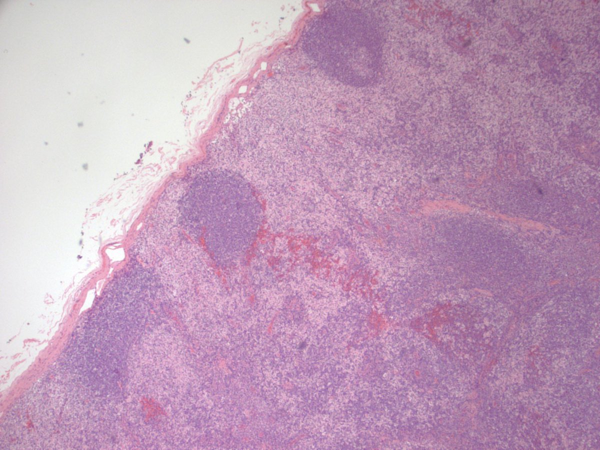Pathoutlines tweet picture