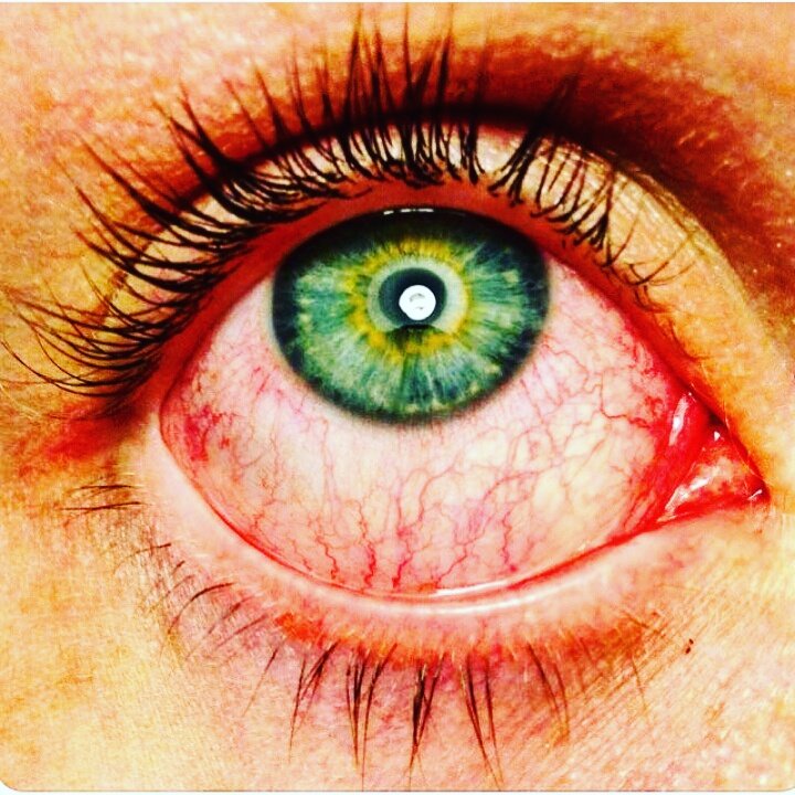 420SmokingClub's tweet photo. Red eyes , big smile https://t.co/r4Ibf8K8aN
